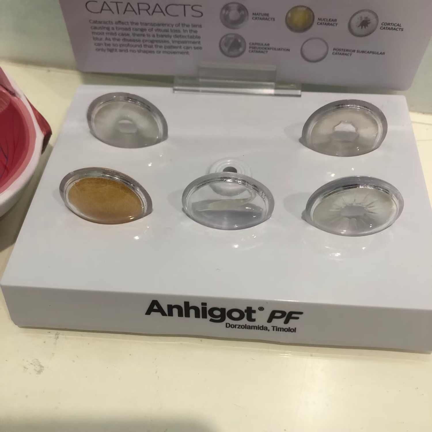 Oogmodel Cataract Oogmodel, Le - Science Exhibition Models recensie en prijs