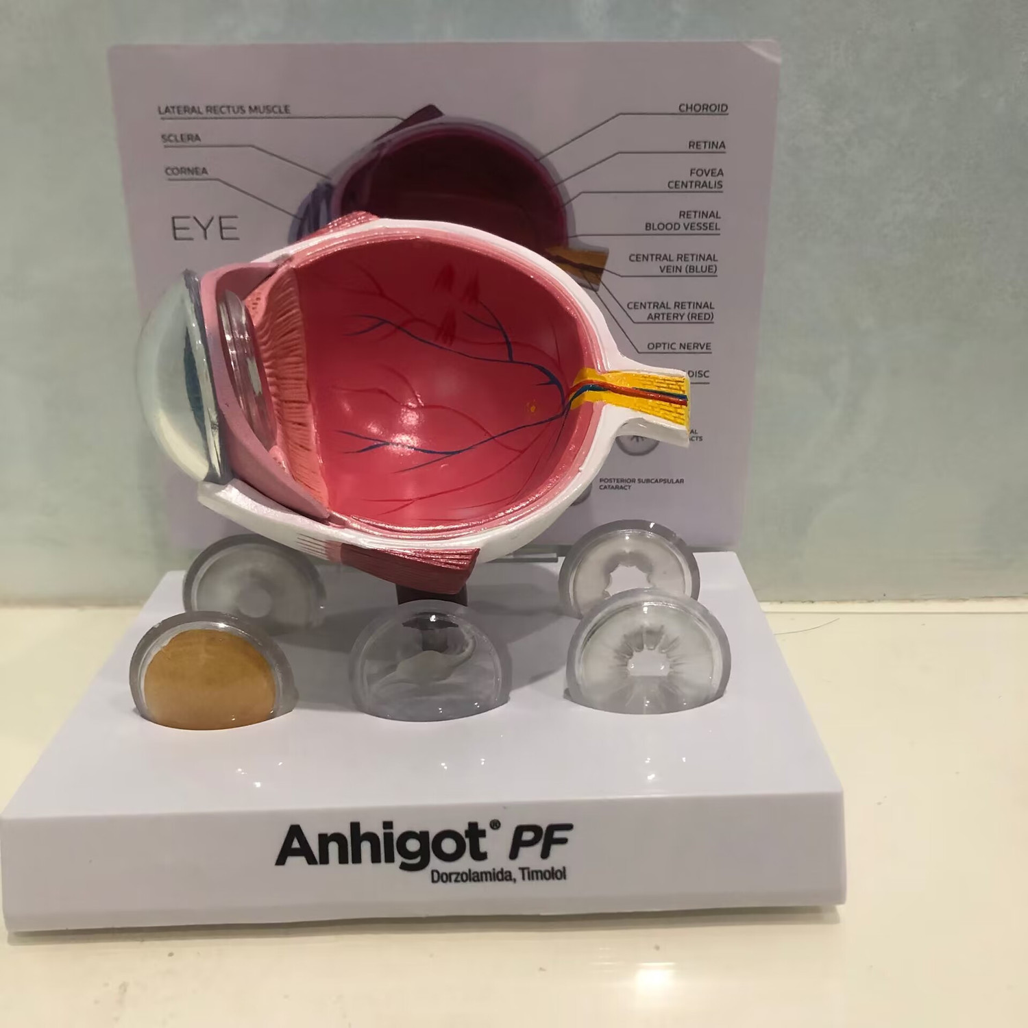 Oogmodel Cataract Oogmodel, Le - Science Exhibition Models recensie en prijs