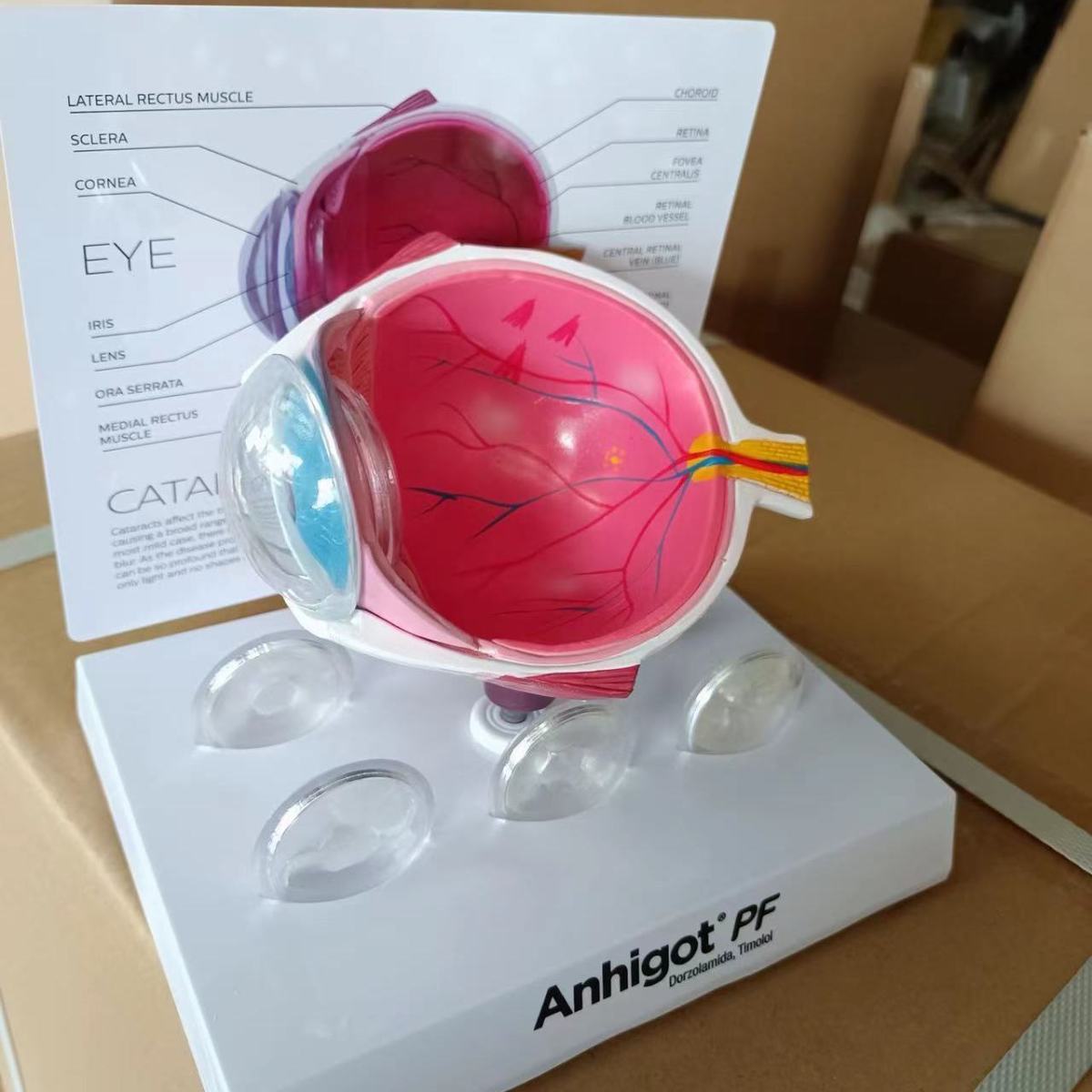 Oogmodel Cataract Oogmodel, Le - Science Exhibition Models recensie en prijs